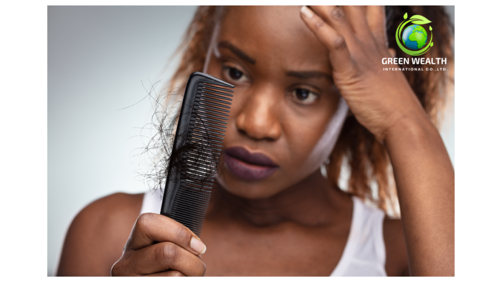 https://www.greenwealthinternational.com/wp-content/uploads/2024/11/hair-loss-in-women-1024x576.png