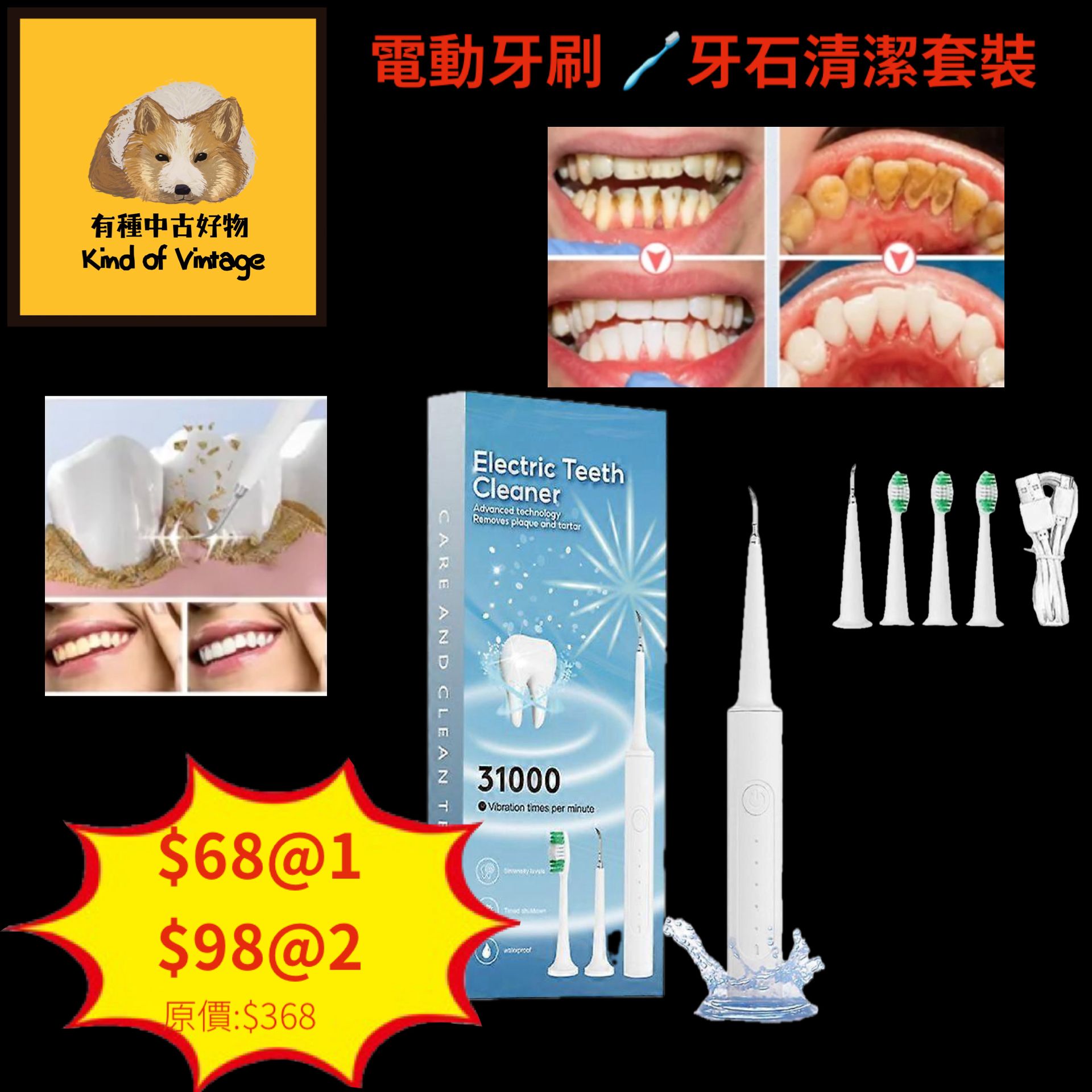 電動牙刷牙石清潔套裝