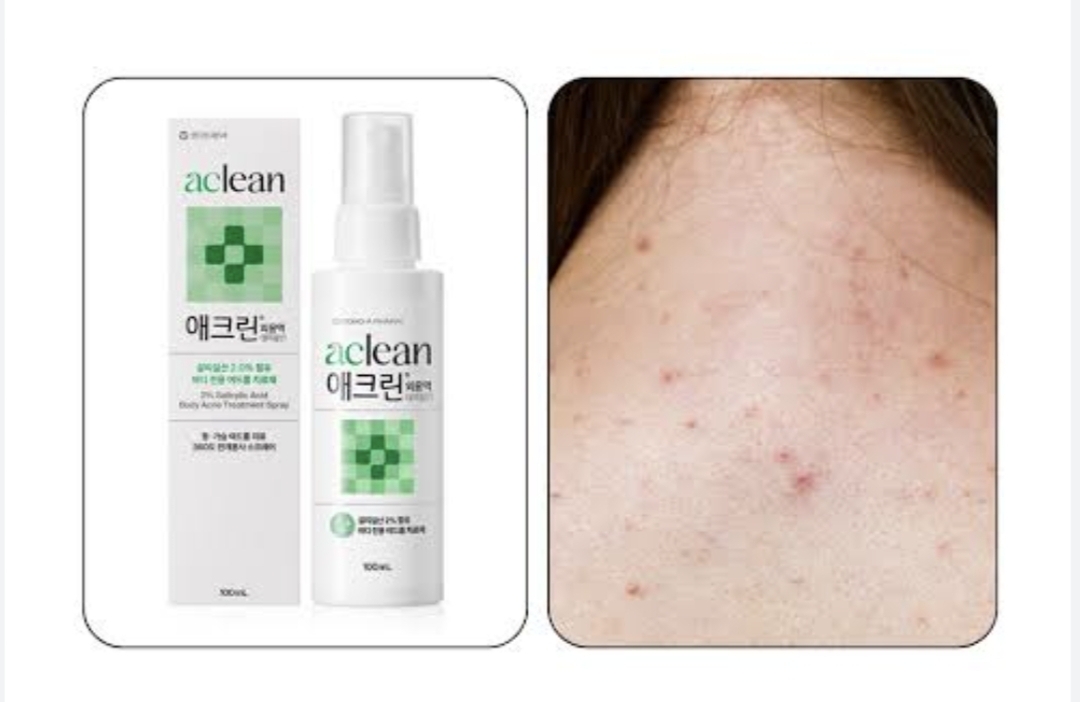 韓國東亞製藥 Aclean 2% 水楊酸身體抗痘噴霧 100ml
