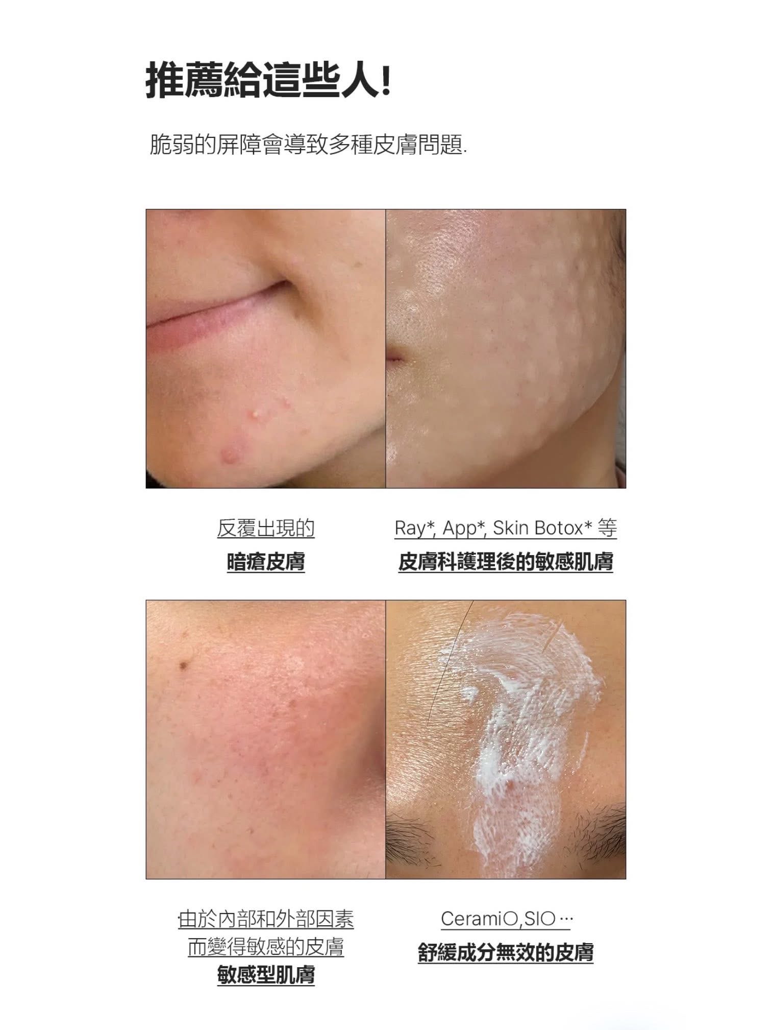 PURCELL PIXCELL BIOM™ 2BILLON/ml Ampoule  20億/mL乳酸菌鎮靜舒緩原液安瓶 30ml 