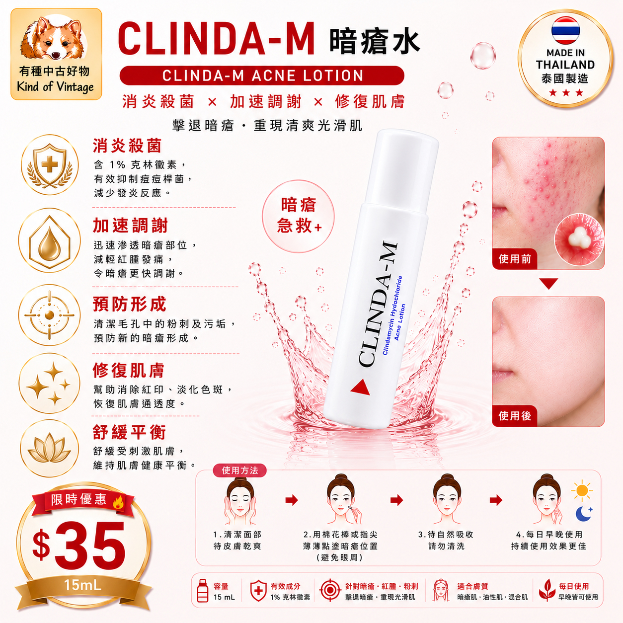 Clinda-M 暗瘡水