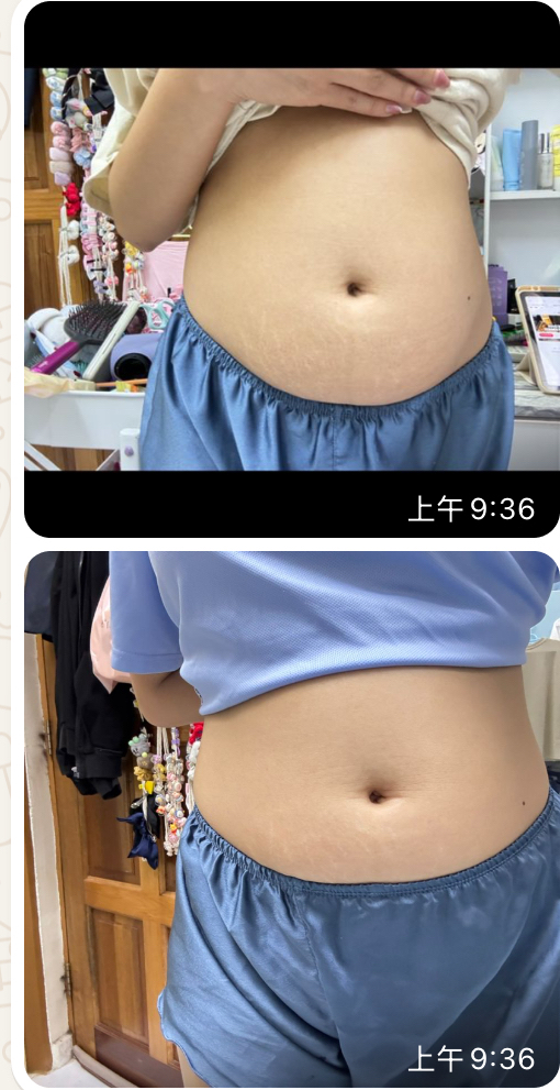 🇲🇾 5 盒 完整一个疗程配套 （ 可服用 30-45 天 ）