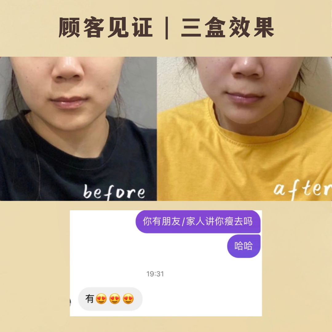 REVERIE瘦脸面膜-热销款