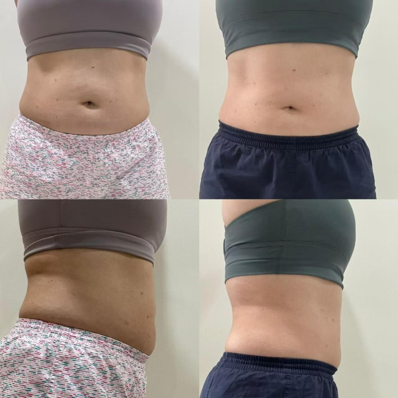 🇲🇾 5 盒 完整一个疗程配套 （ 可服用 30-45 天 ）