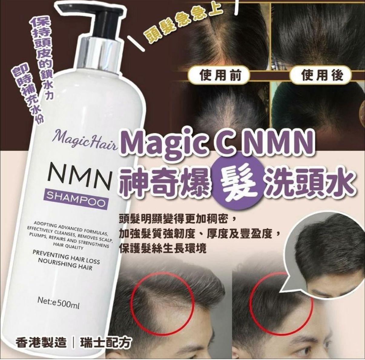 大熱產品💜Magic NMN 防脫髮蠶絲蛋白系列 