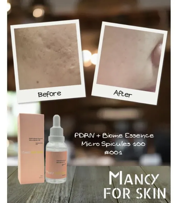 【Mancy For Skin】 精華護膚系列|精華素、精華面膜|強靭肌膚底層至真皮層|深層補水|減少暗沉和抗氧化|舒緩鎖定與抗炎|修護皮膚屏障【8/9 截單，預計 :8月尾至9月中發貨】