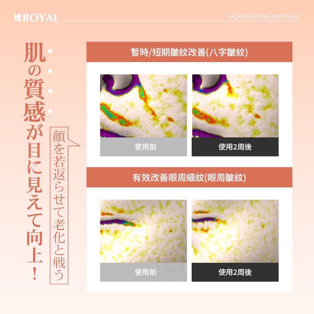 $65組4支。2組起$55組,日本 ROYAL SalmonPDRN煥顏安瓶精華 2ml*4入組