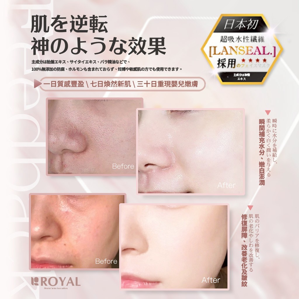 YW260430 - 日本ROYAL®多胜肽貴婦逆齡精華液 30入/盒