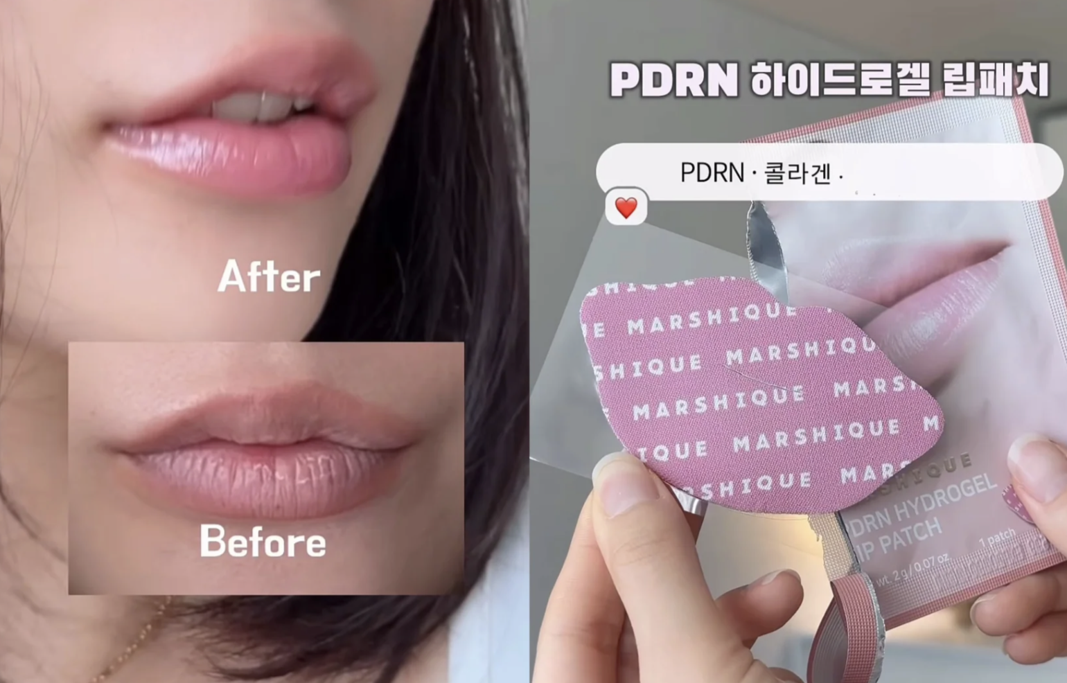 韓國 Marshique PDRN 深層修護水凝膠唇膜 5片裝｜Hydrogel Lip Patch