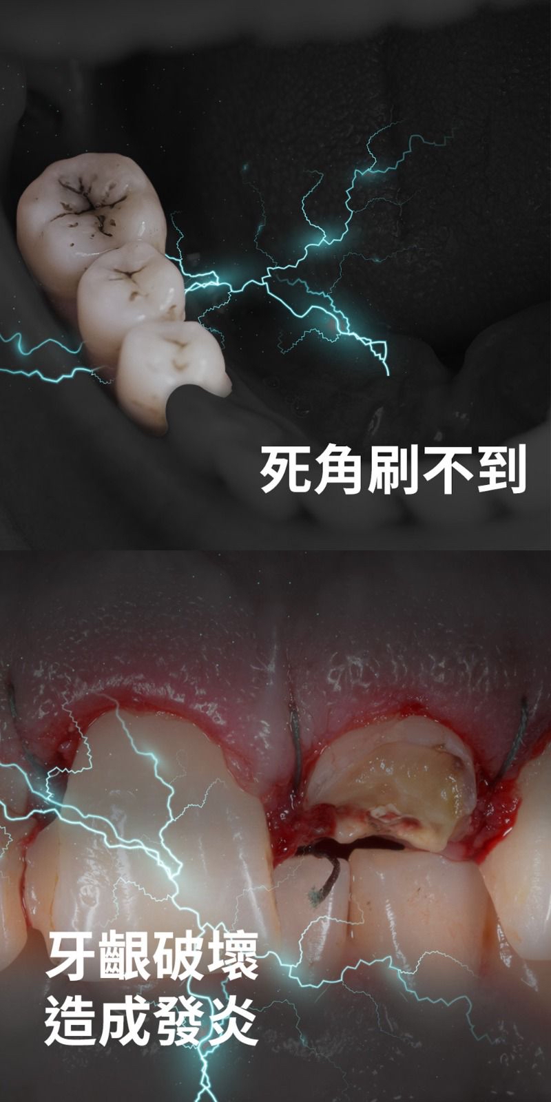 【F.F】U CLEAN 亮齒微笑儀