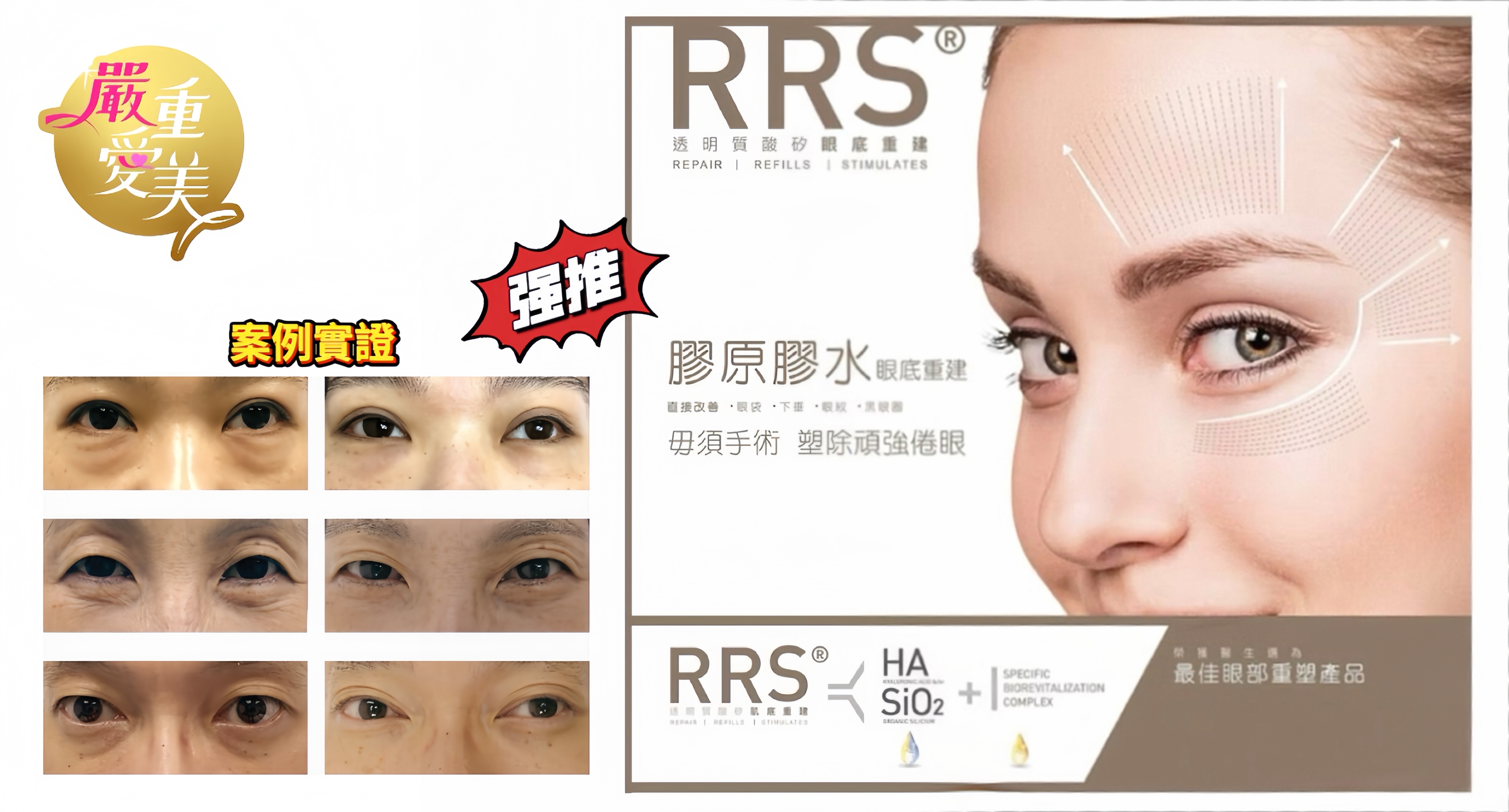 精靈眼重建療程90mins-6次