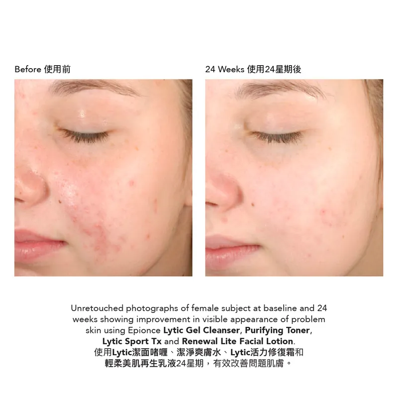 Epionce Lytic Sport Tx Retexturizing Lotion 活力修復霜