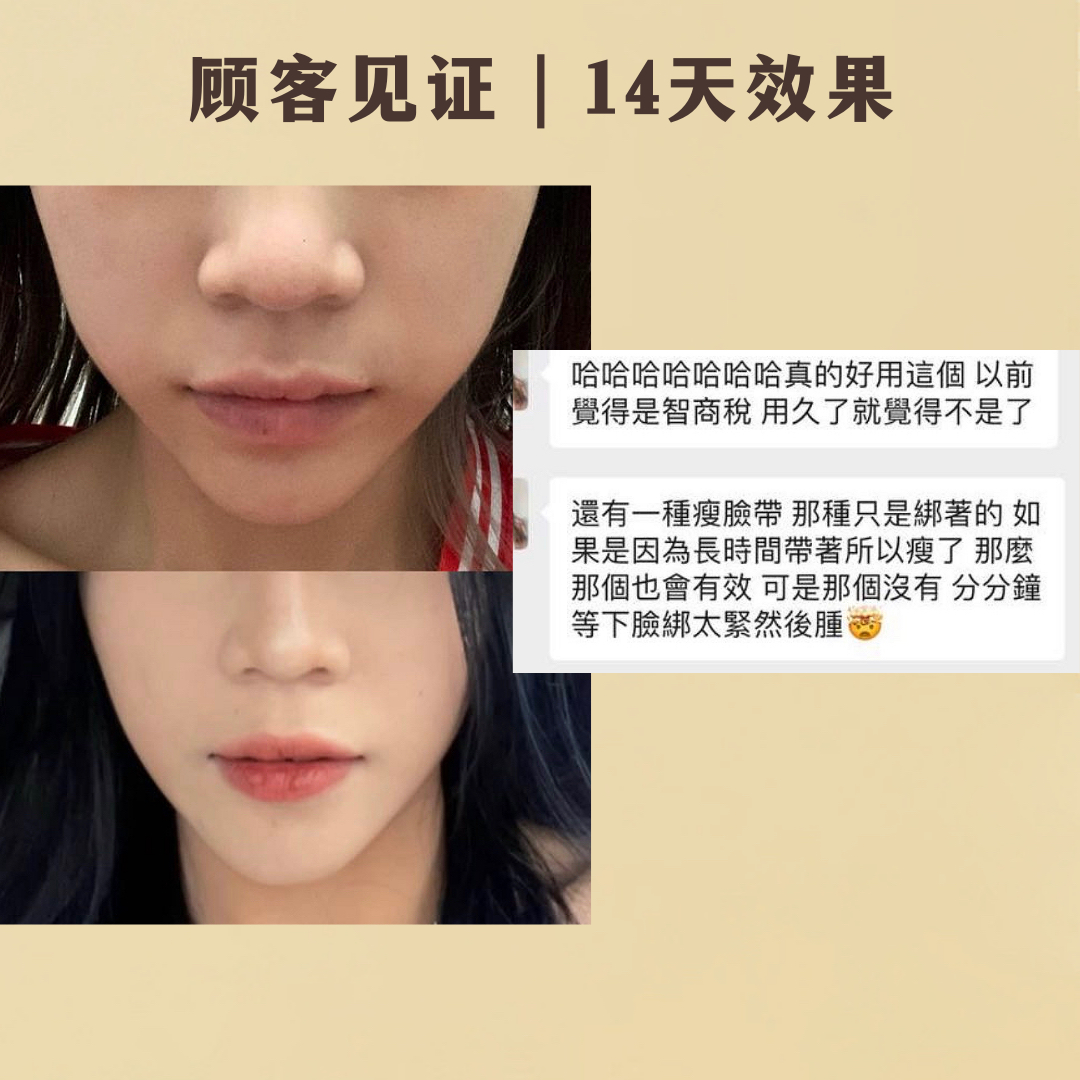 REVERIE瘦脸面膜-热销款