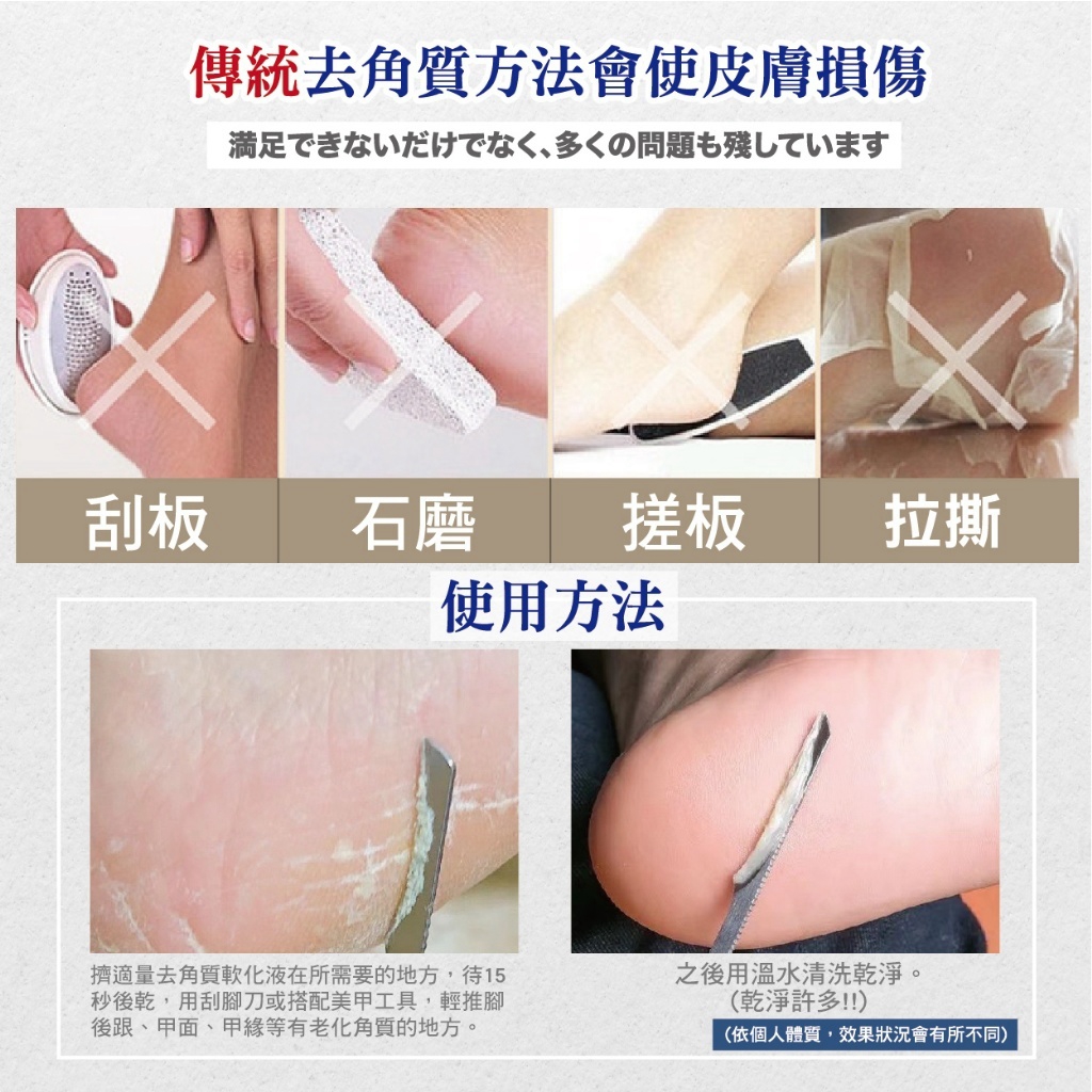 ＜限時預購＞ 淨美肌 死皮角質軟化液 30ML TW261026S01 《30/10截單，預計11月下旬到港》