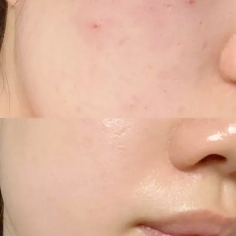 韓國🇰🇷直送✈️Meditherapy藍色積雪草舒緩面霜100m