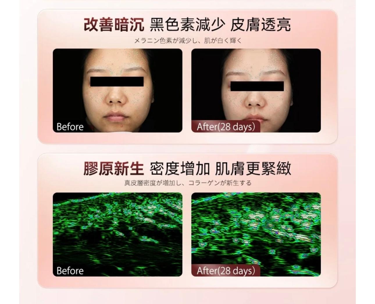 行貨1年保養JUJY 升級版逆齡煥膚美光機 PRO包面膜5片 