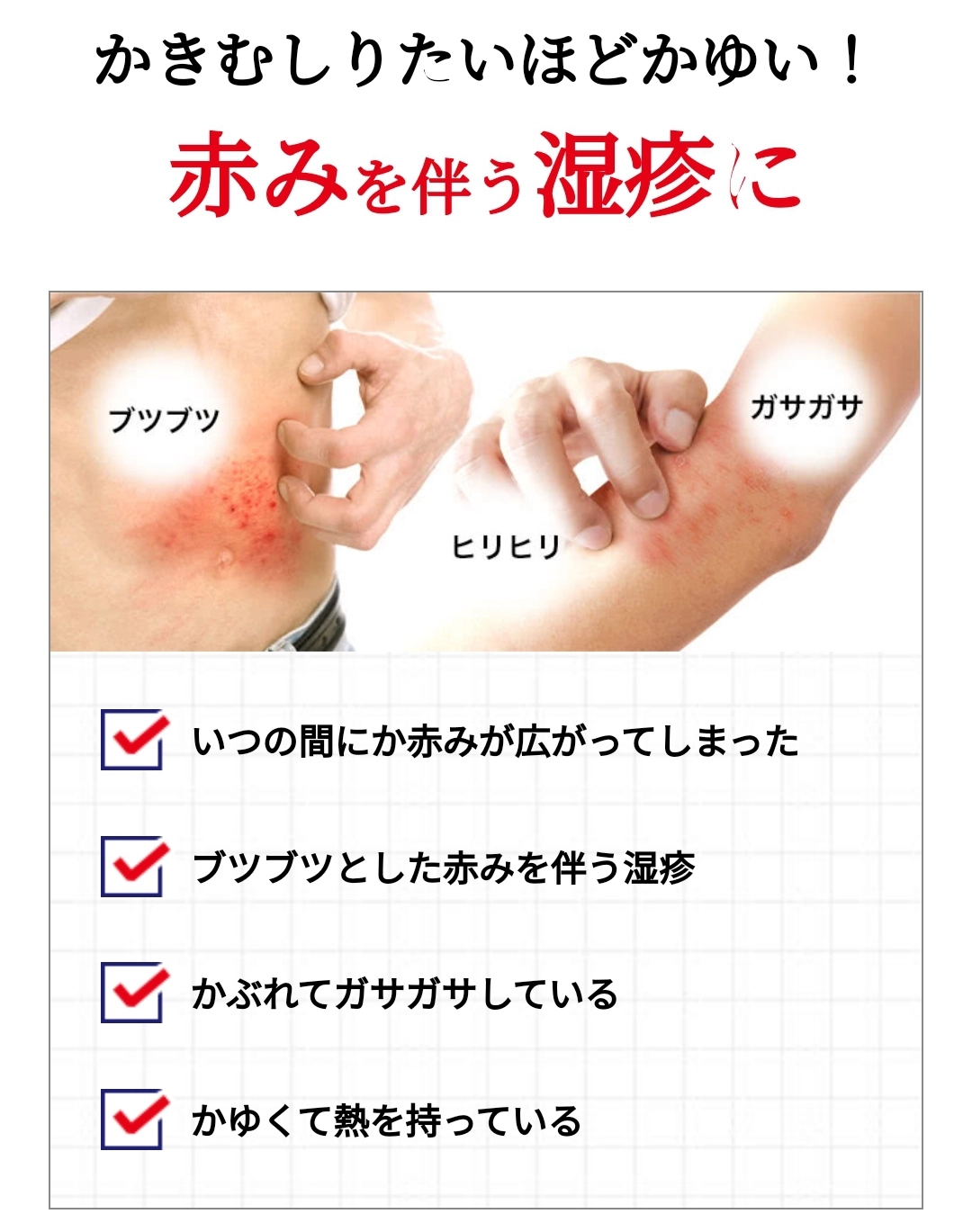 日本曼秀雷敦Medi Quick PRO濕疹治療膏 8g 清爽乳霜型 