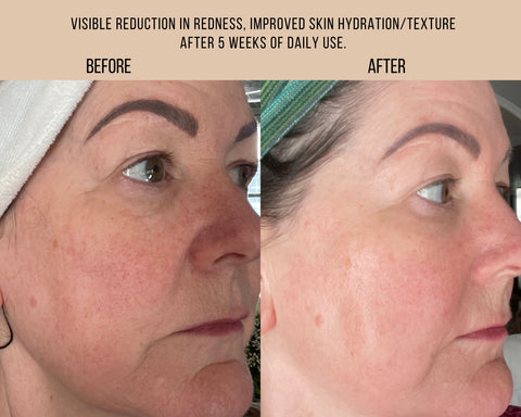 Free + True 藍調艾菊修護精華液