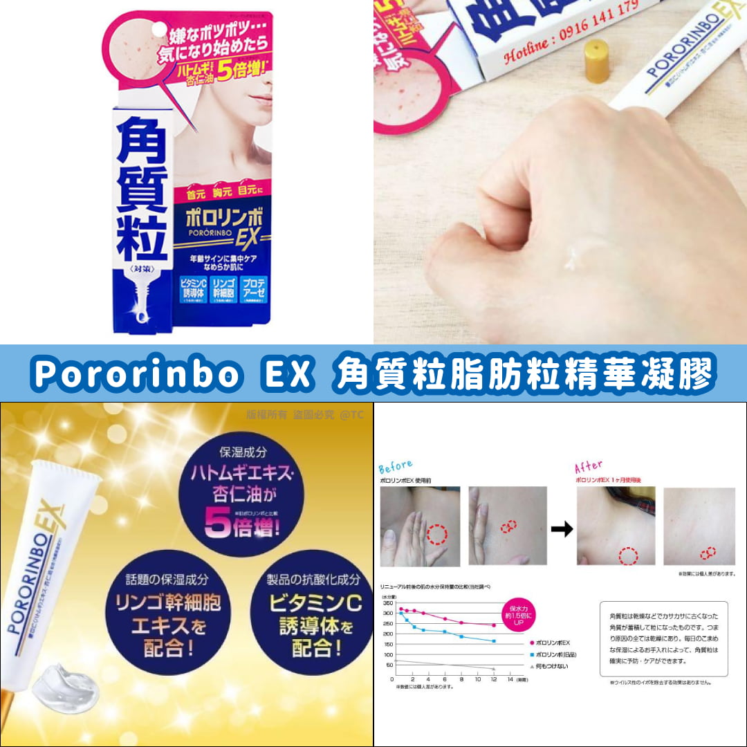 【日本製造 Pororinbo EX 角質粒脂肪粒精華凝膠 18g】