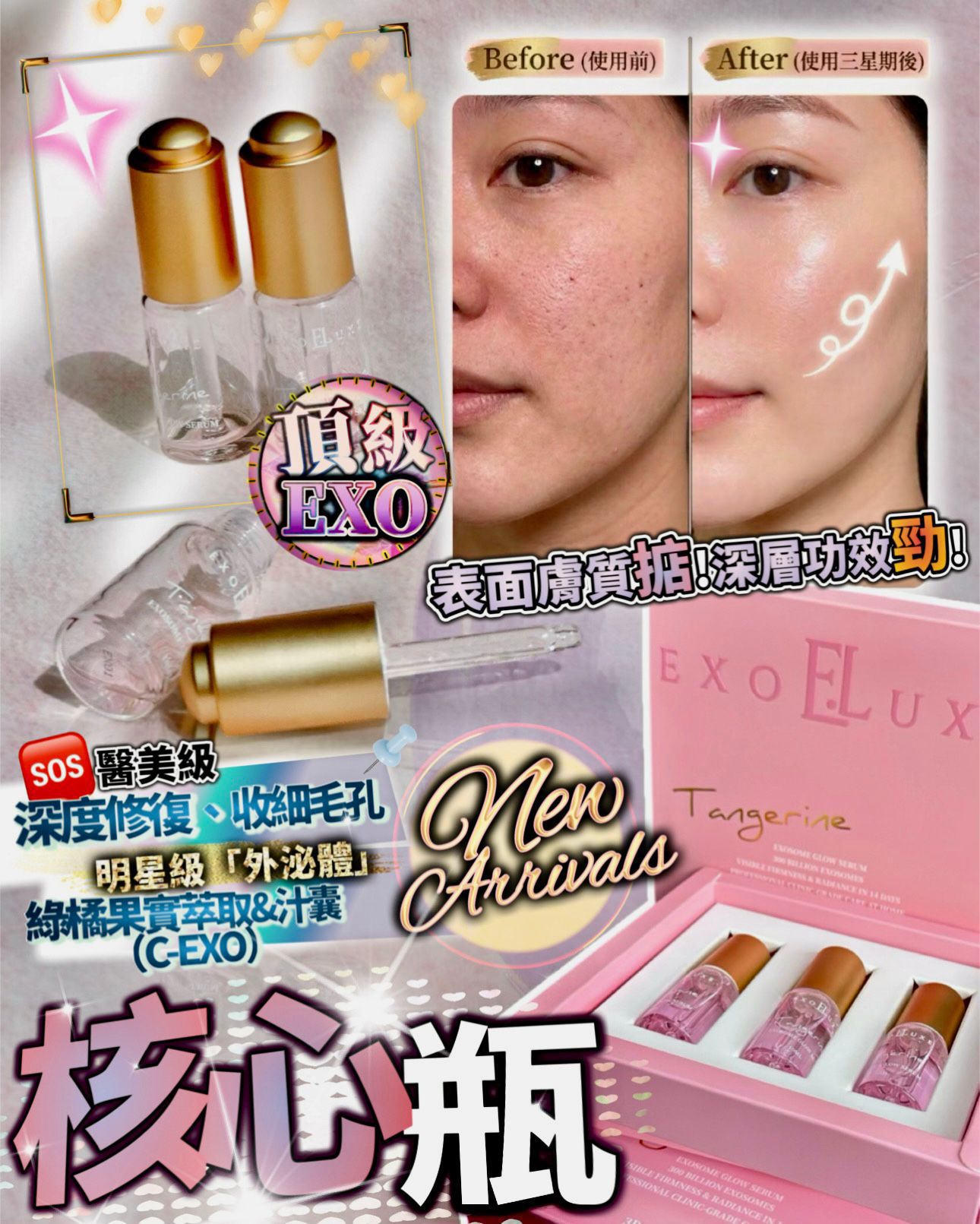 💖 EXO 💖 核心瓶 💖 (1盒3支) 