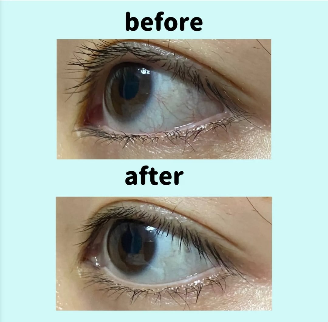 LION獅王Smile Whiteye美白眼球緩解疲勞眼藥水15ml