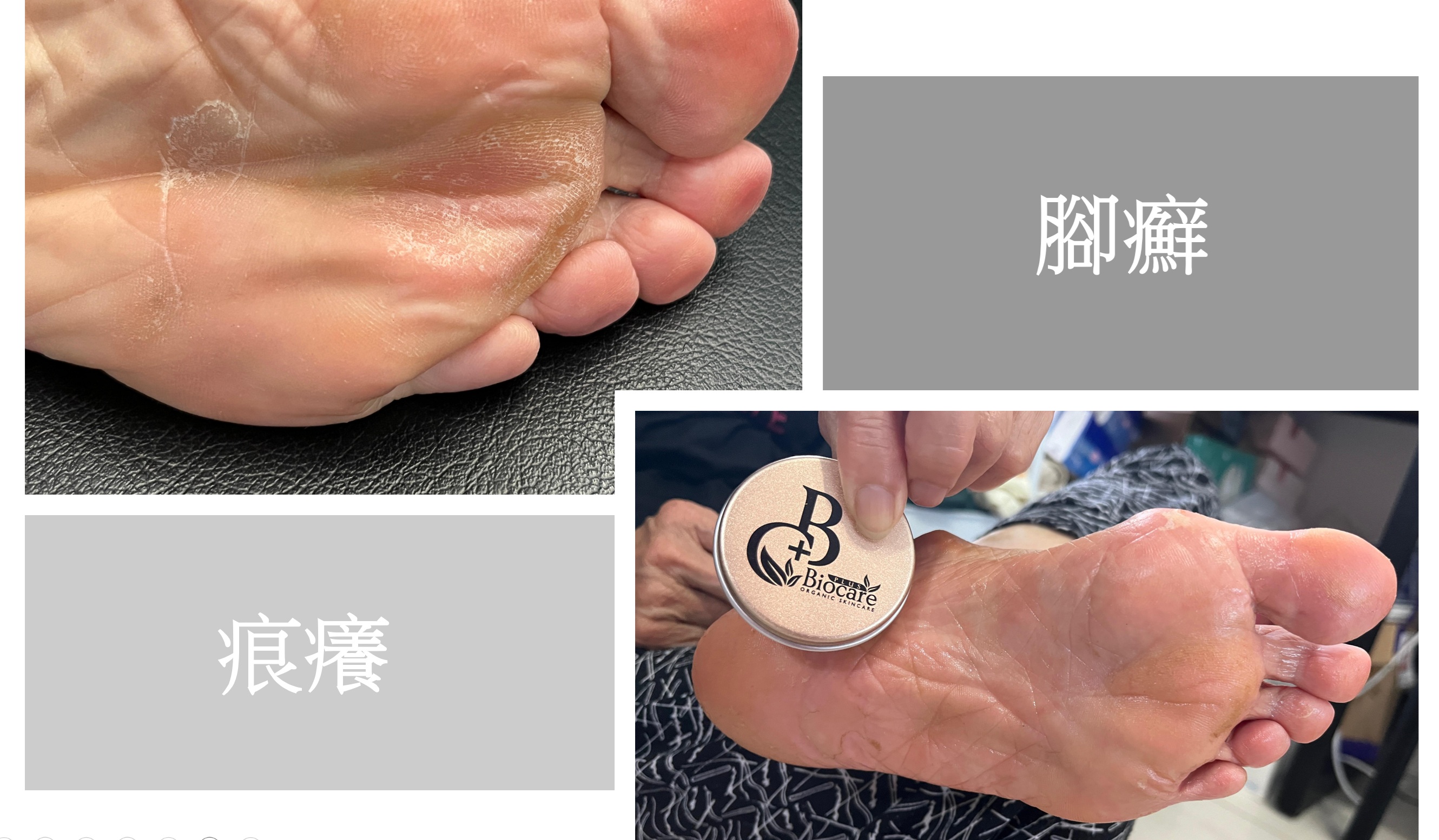 有機扁桃斑鳩菊油膏(嬰兒款)-蚊叮蟲咬/消腫止痕/濕疹/尿布疹及奶癬