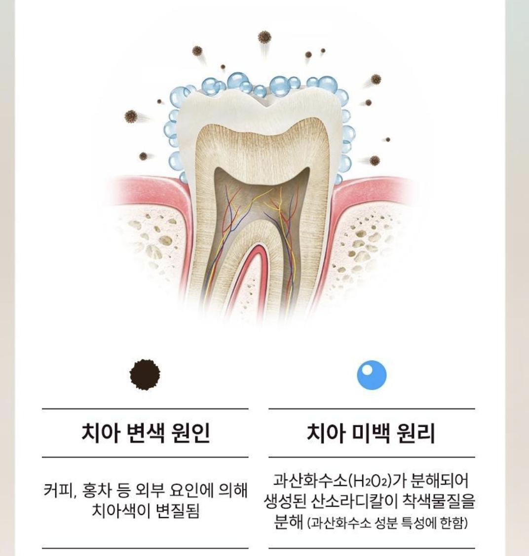 韓國 Vussen 15 醫美級 強效美白牙膏 80g | 15 Brightening Toothpaste
