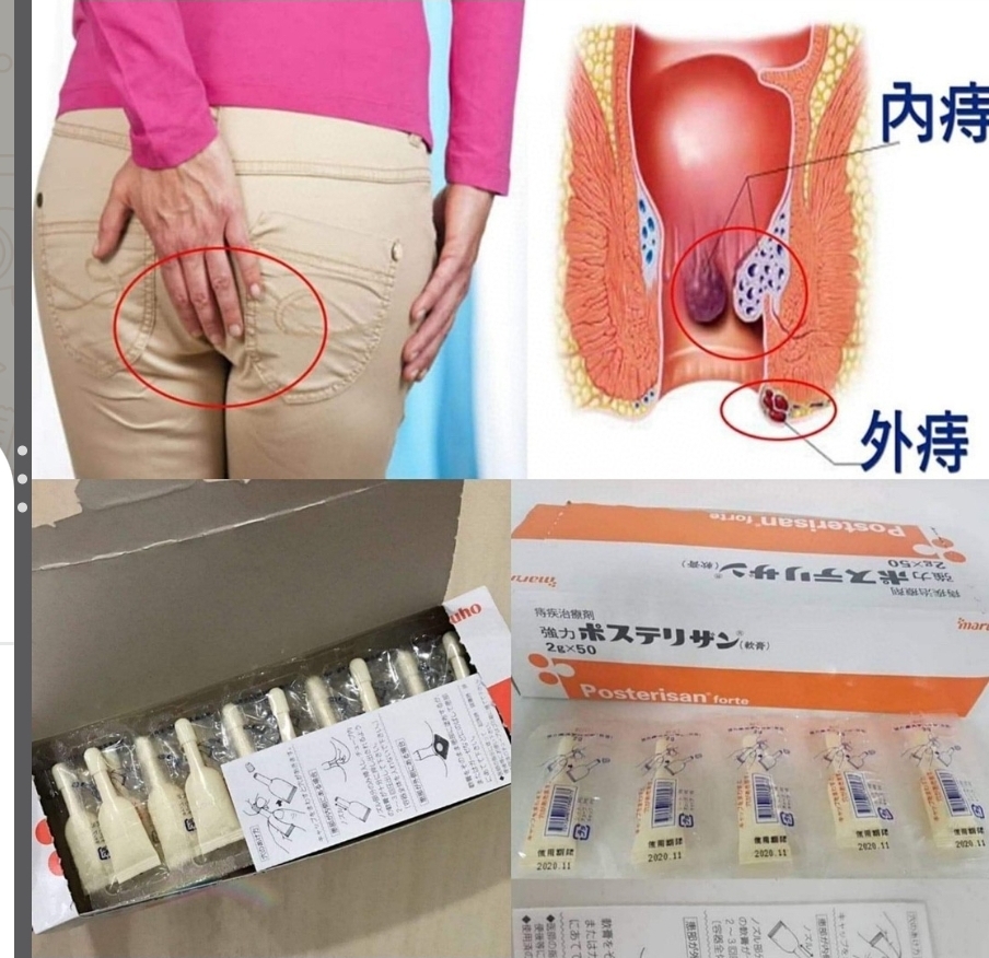 $55排5支。2排起$45排。日本👨‍🔬醫生推薦的痔瘡膏