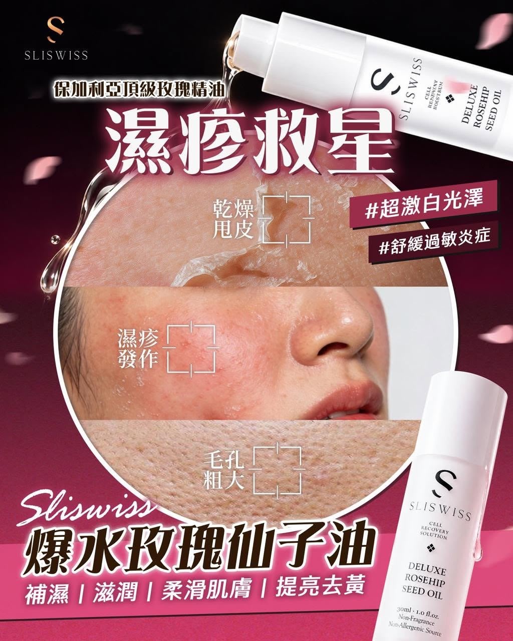Sliswiss 爆水玫瑰仙子油｜保加利亞玫瑰果精油 補濕滋潤提亮
