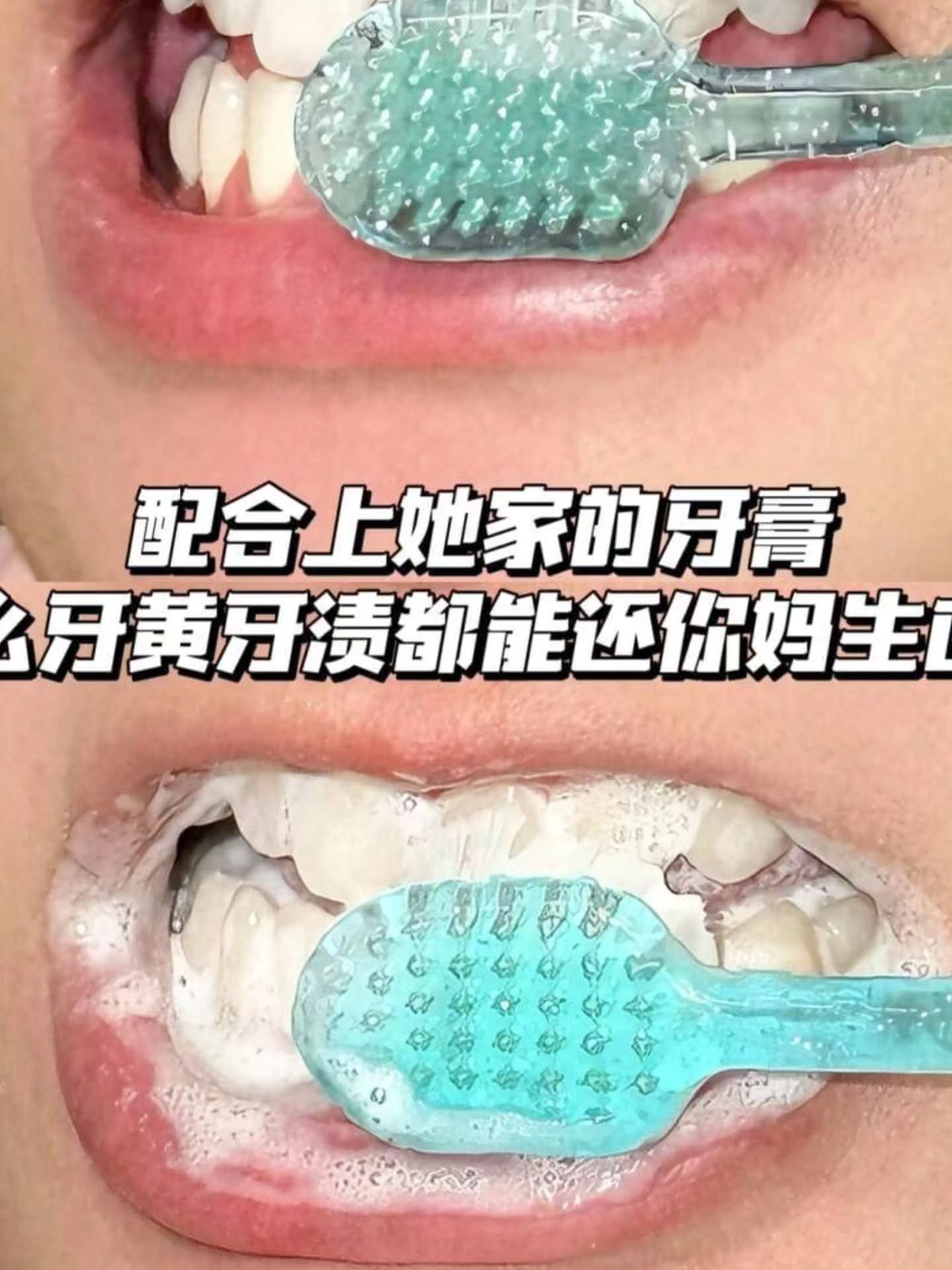 🇯🇵日本Ora2美白牙膏系列