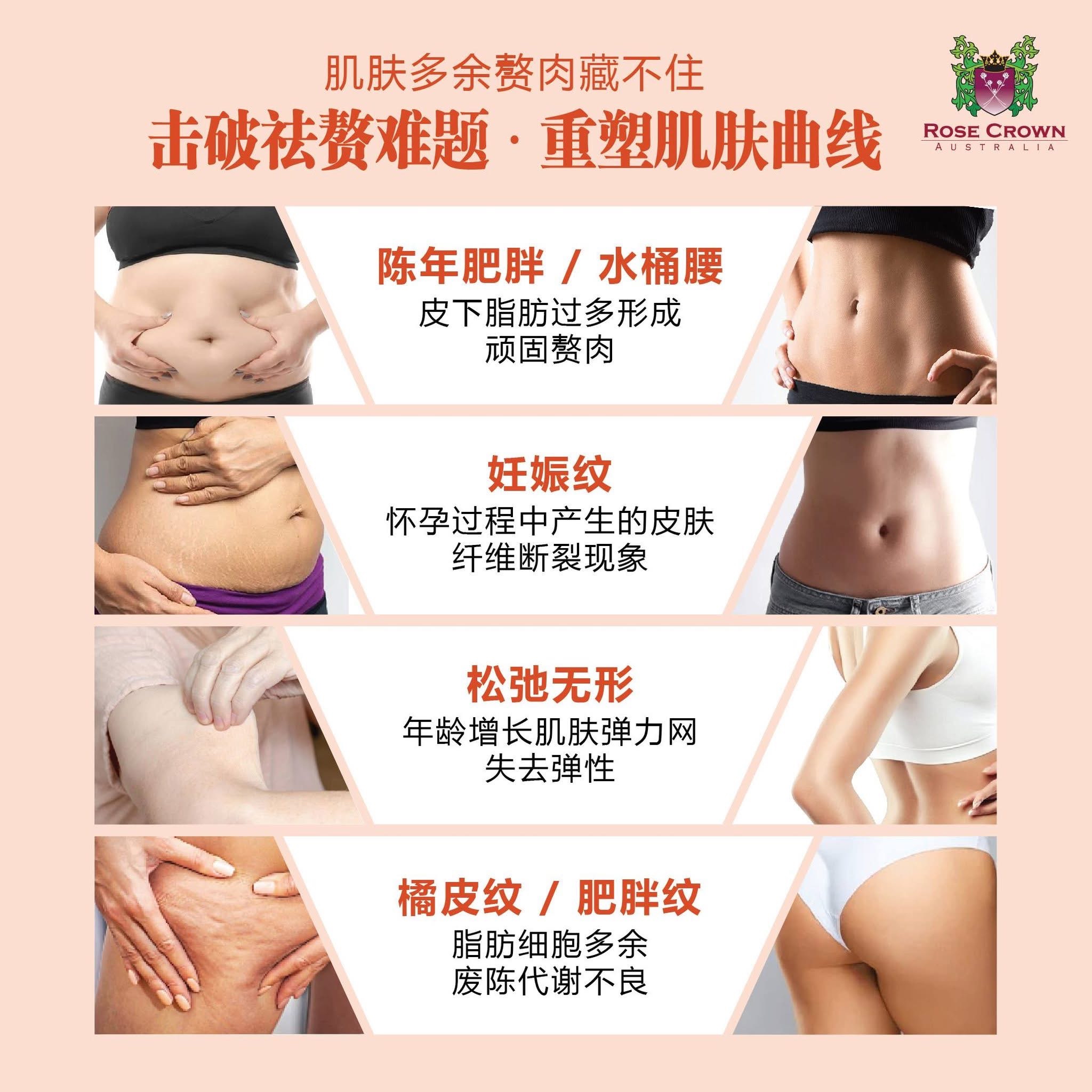 Rose Crown Cellutox 100ml