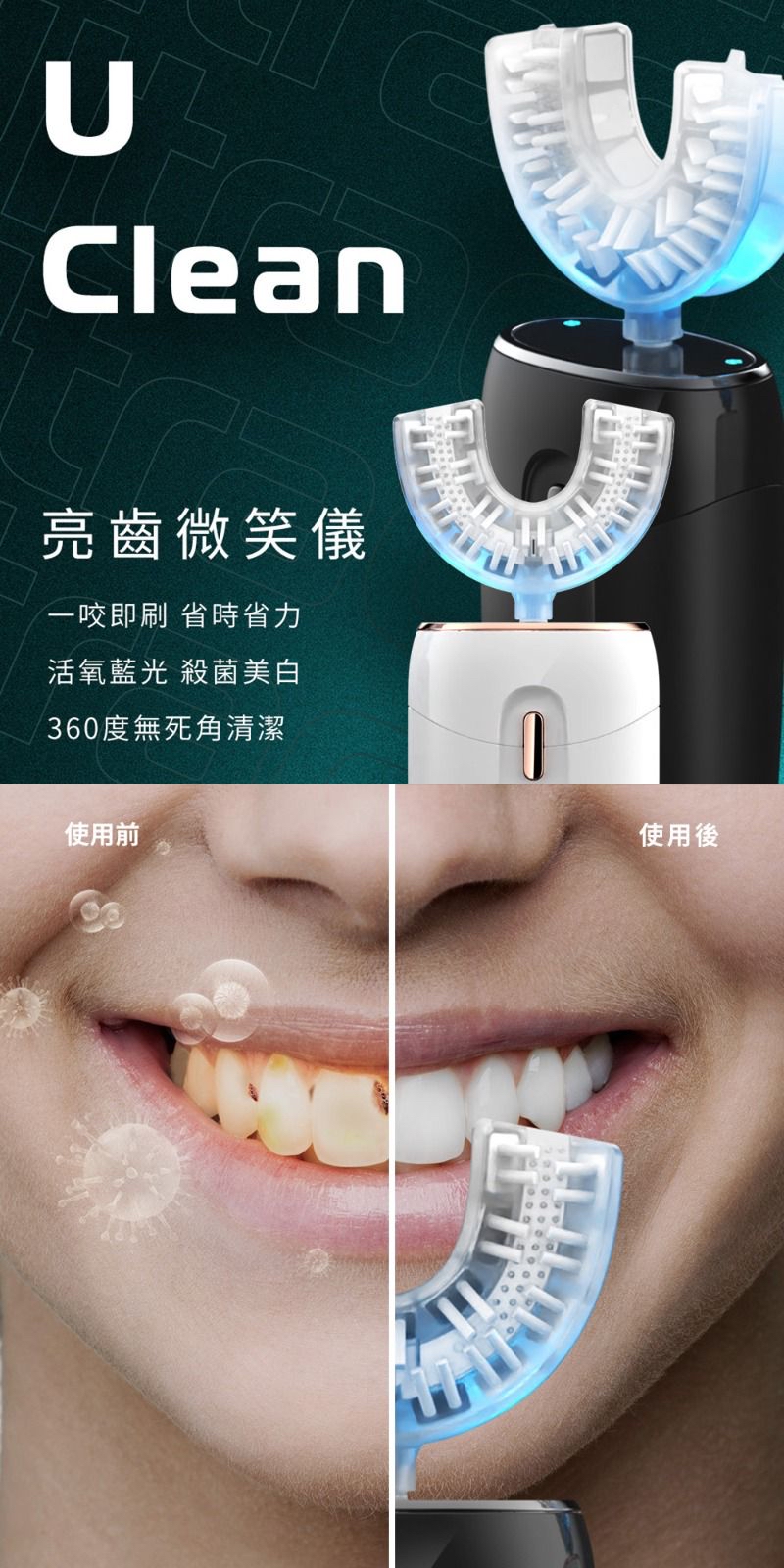 【F.F】U CLEAN 亮齒微笑儀