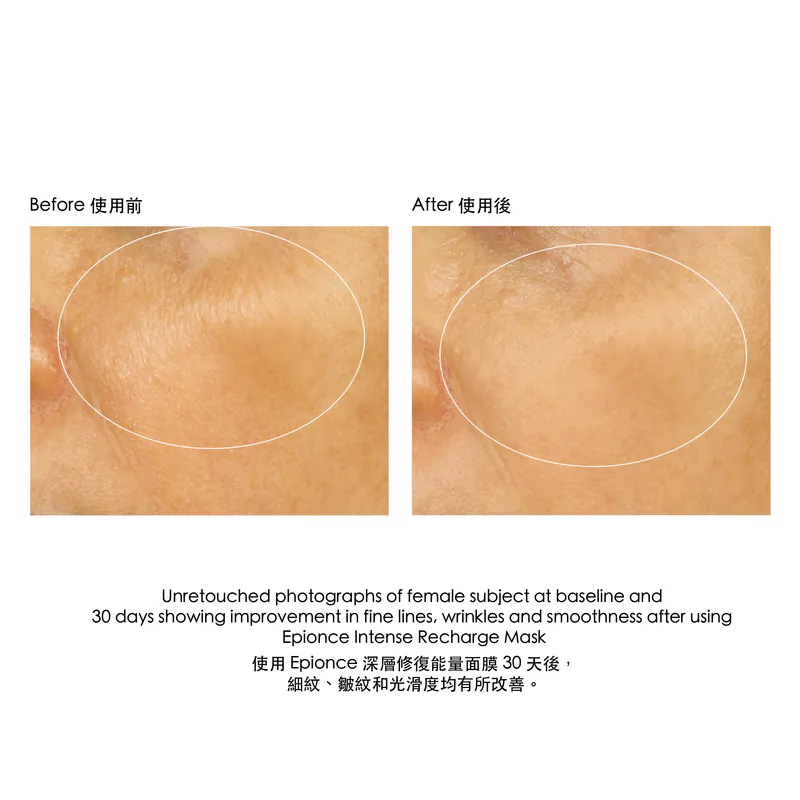 Epionce Intense Recharge Mask 深層修復能量面膜 BBE 9/26