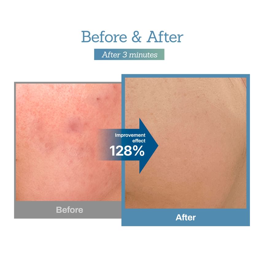 韓國🇰🇷直送✈️Meditherapy藍色積雪草舒緩面霜100m