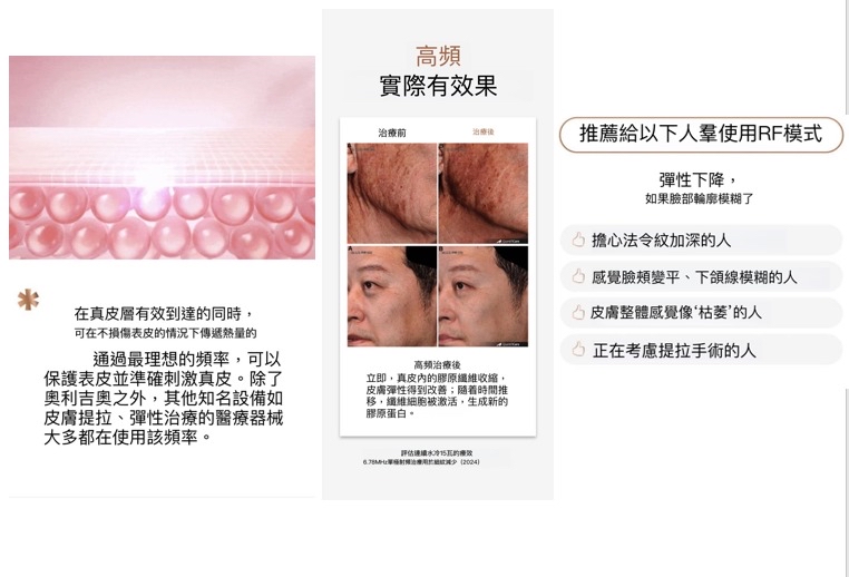 預訂~Oligio 第一部全效家用美容儀套裝 - Oligihome 