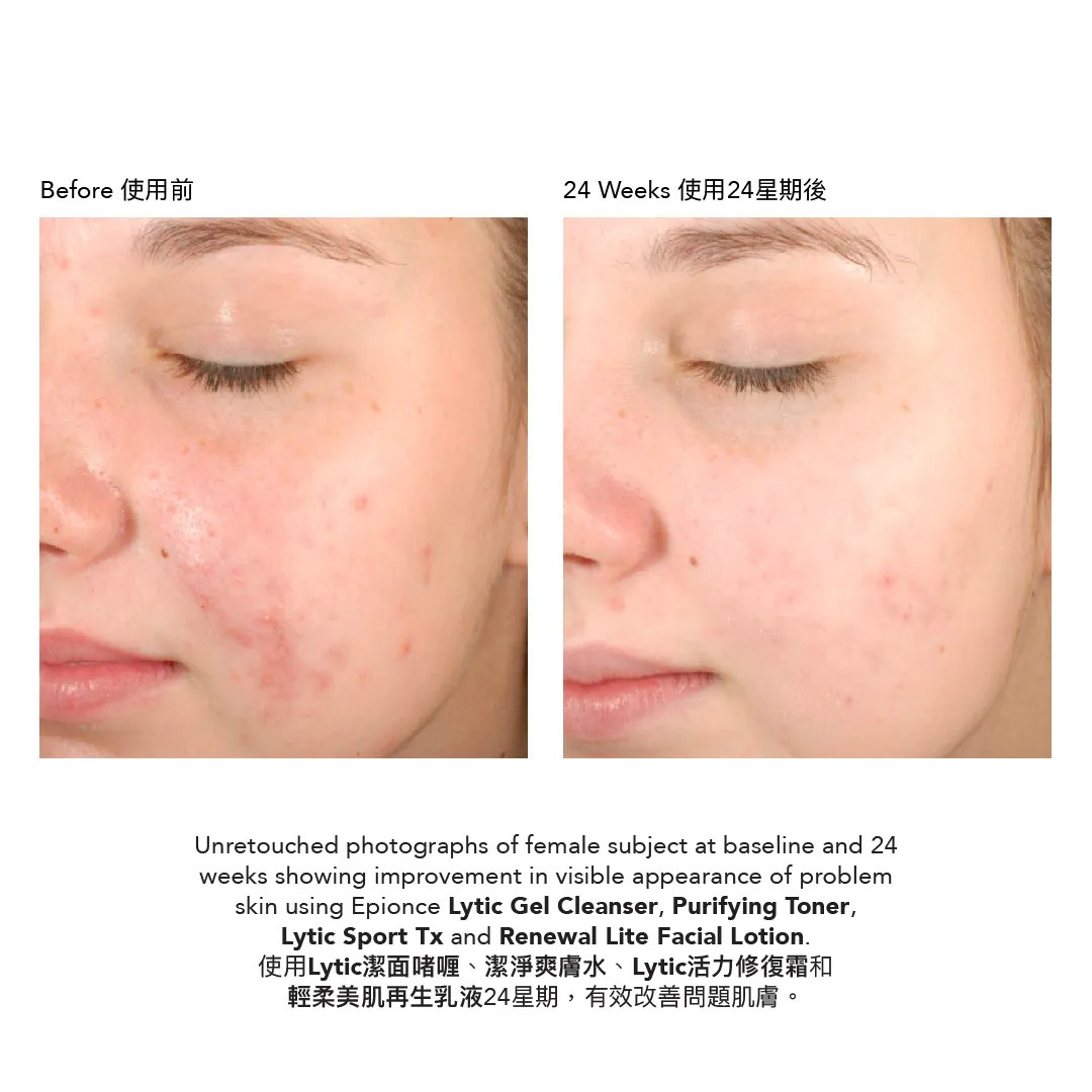 Epionce Lytic Gel Cleanser 潔面啫喱