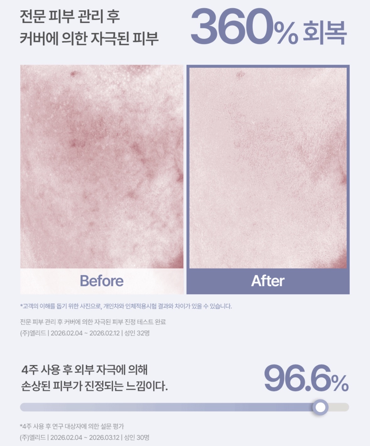 [韓國espoir] espoir x AESTURA 共同研發 BB Derma Cover BLEMISH BALM SPF50+ PA++++ 限時送AESTURA Cleansing Form 2x30g (預購商品）