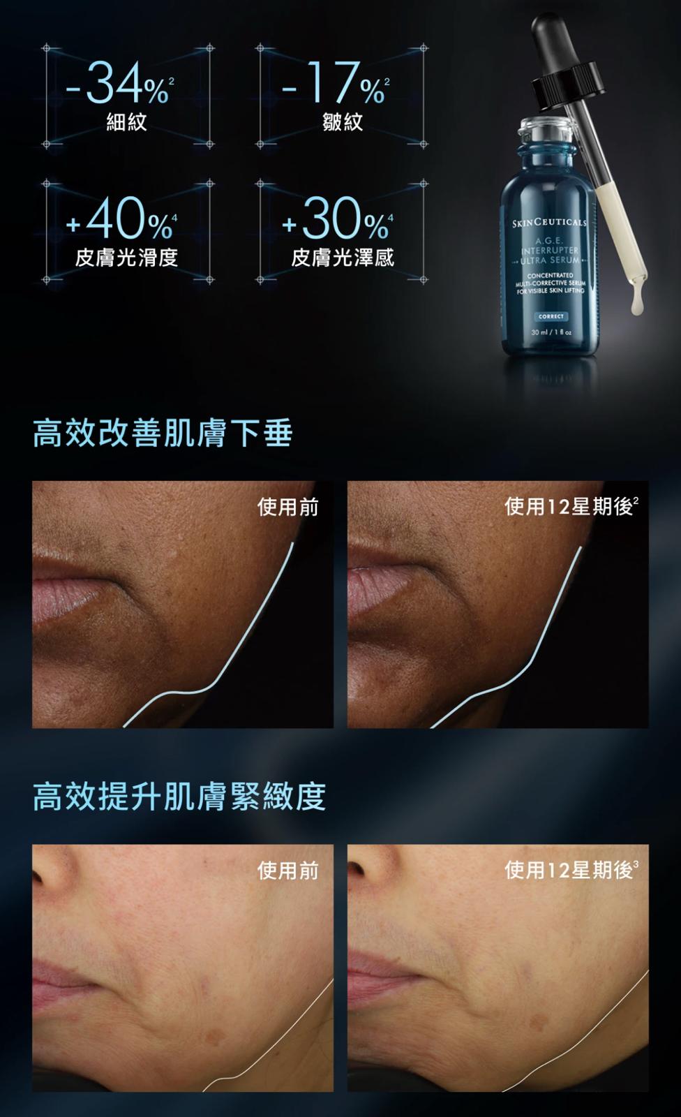 Skinceuticals A.G.E.抗醣極效緊緻精華 15ml