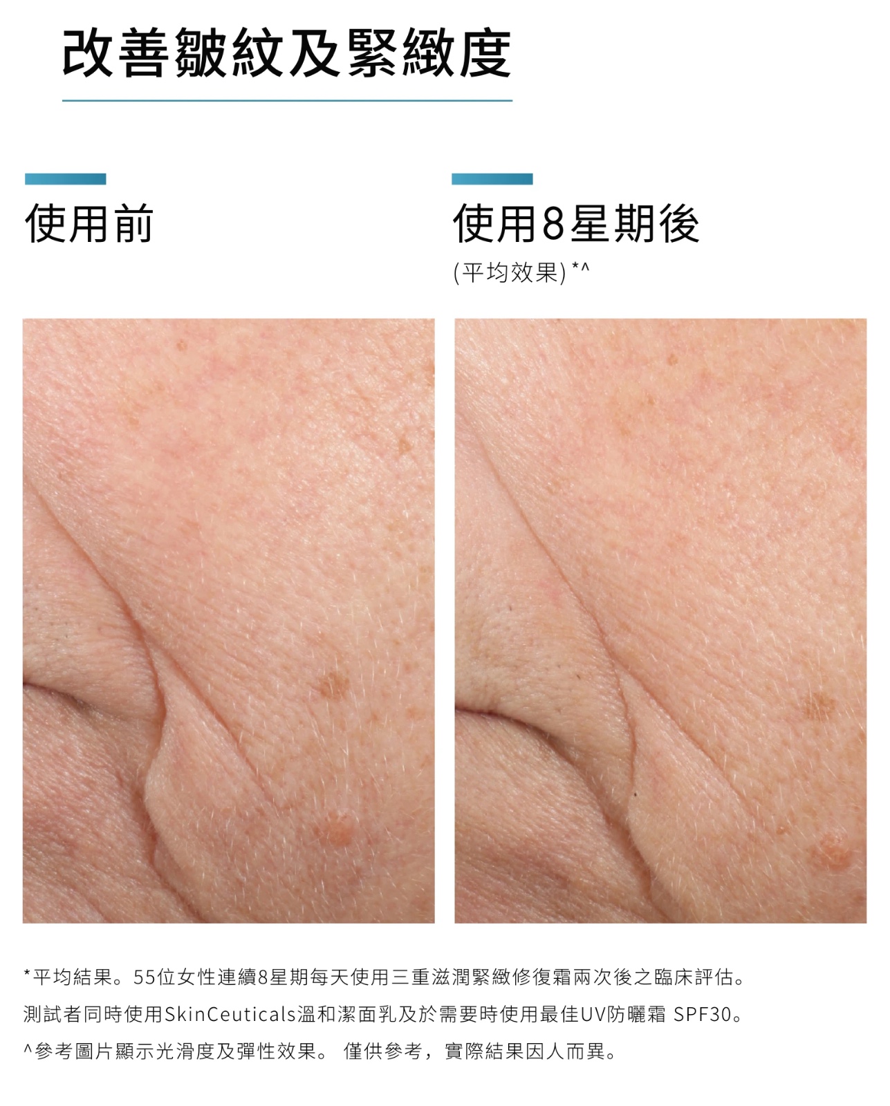 (現貨) SKINCEUTICALS 三重滋潤緊緻修復霜 Triple Lipid Restore 2.4.2 48ml