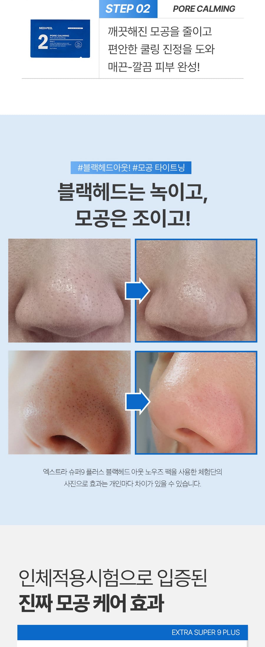 Medi-Peel - Extra Super 9+ 去黑頭、白頭清潔鼻貼套裝
