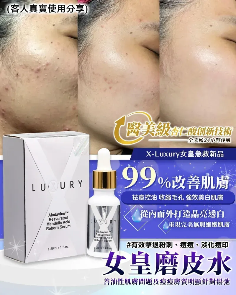瑞士X Luxury 女皇磨皮水精華20ml