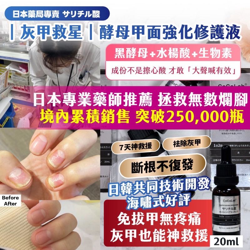 $49支.2支或以上 $39支.韓國藥局專賣 J-iromise 灰甲救星酵母甲面強化修護液20ml