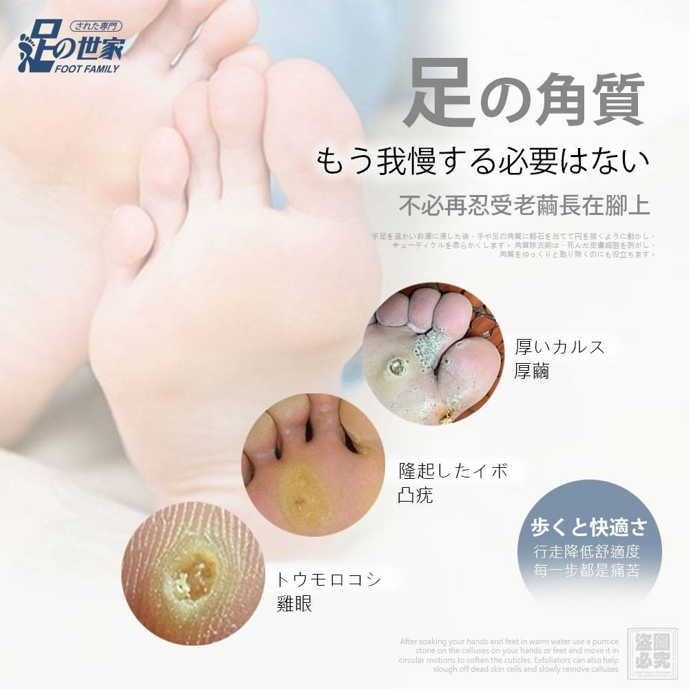 用於治療腳部老繭和雞眼的貼片。
