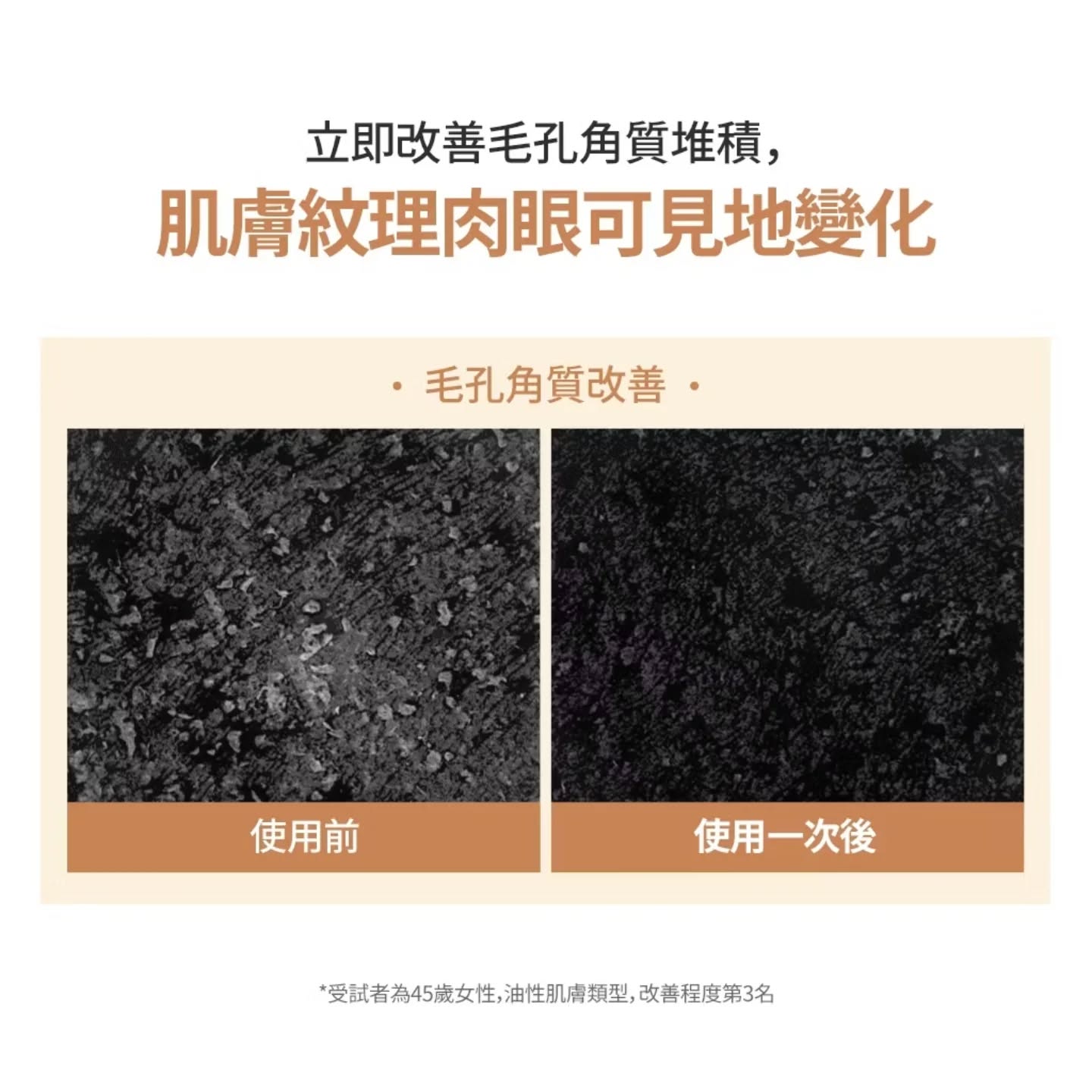 優惠現貨💜 SAM'U潔顔粉 SAMU潔顔粉  SAM'U SAMU SAM'U潔面粉 SAMU潔面粉 潔面粉 SAM'U洗面粉 SAMU洗面粉 洗面粉 潔顔粉 酵母潔顏粉 SAM'U酵母潔顔粉 SAMU酵母潔顔粉 深層清潔 磨砂 毛孔潔顏粉 SAMU毛孔潔顏粉 毛孔潔面粉 SAMU毛孔潔面粉 酵母潔顏粉 SAM'U潔顏粉 SAMU潔顏粉 SAM'U拉絲潔顏粉 拉絲潔顏粉 神級拉絲潔顏粉 神級潔顏粉 SAMU毛孔潔顏粉 SAM'U毛孔潔顏粉 酵素毛孔淨膚潔顏粉 韓國日本😃優惠$145💜原價$165💜