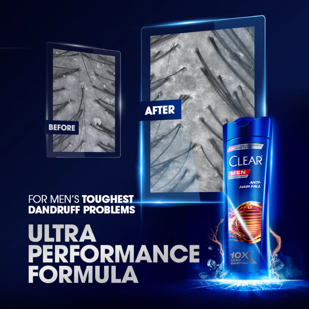 Clear Men Shampoo 170ml - Anti Hair Fall