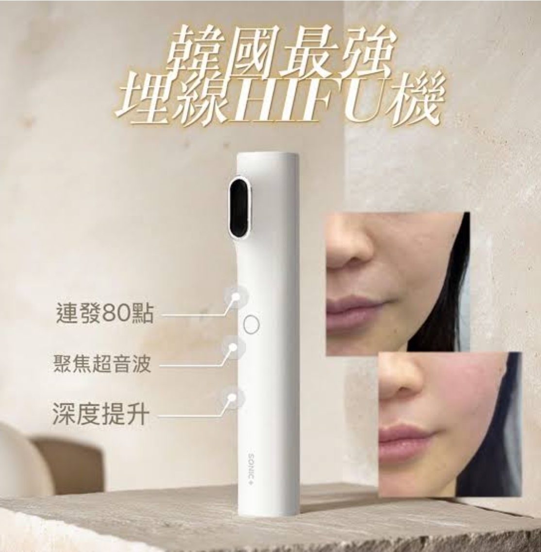 $1280。3mm穿透級釘緊💎80 HIFU+LDM🚀