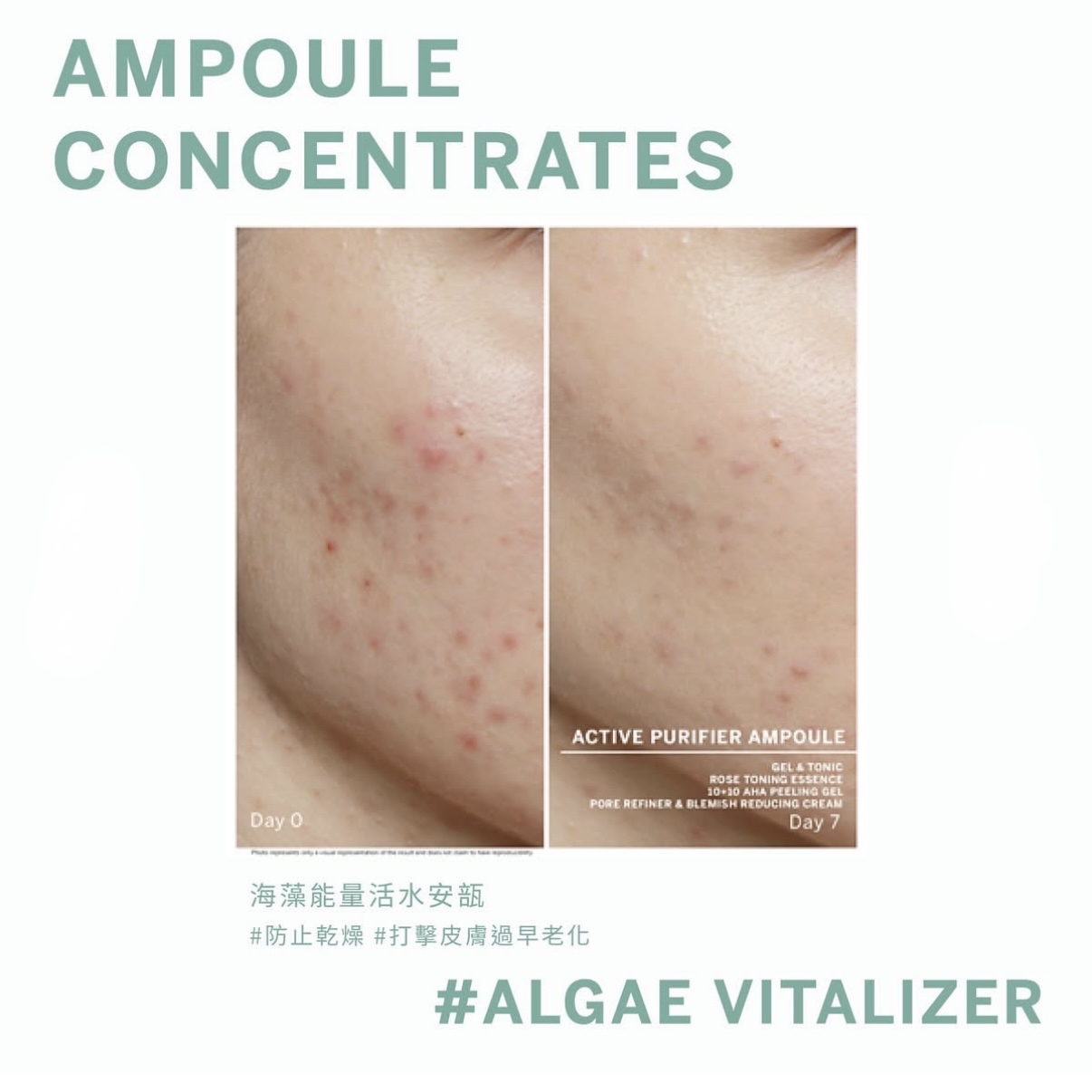 🇩🇪德國BABOR  海藻能量活水安瓶精華 Algae Vitalizer