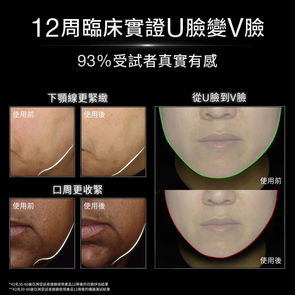 【SkinCeuticals】A.G.E極效賦活緊緻精華 30ml
