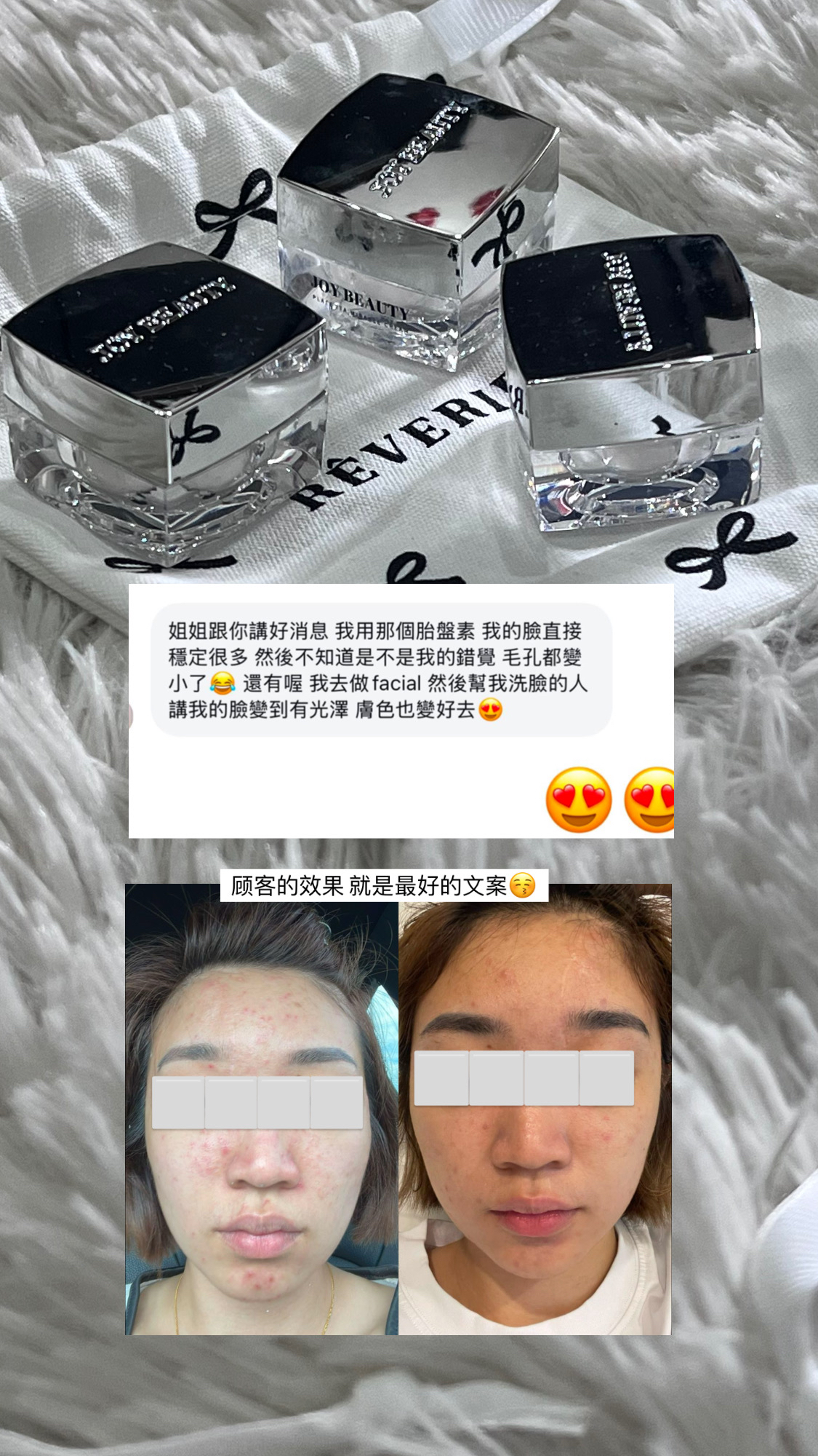 胎盘膏  5g体验装