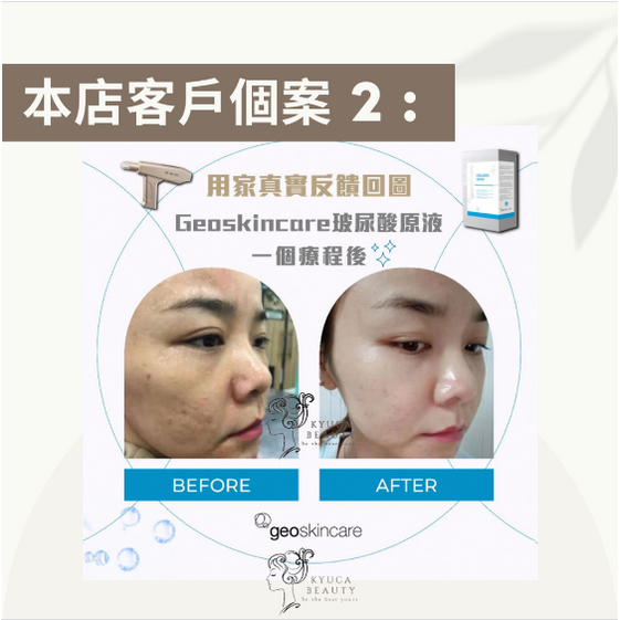 【 居家必備 】玻尿酸保濕精華原液 ( 一盒8支 )